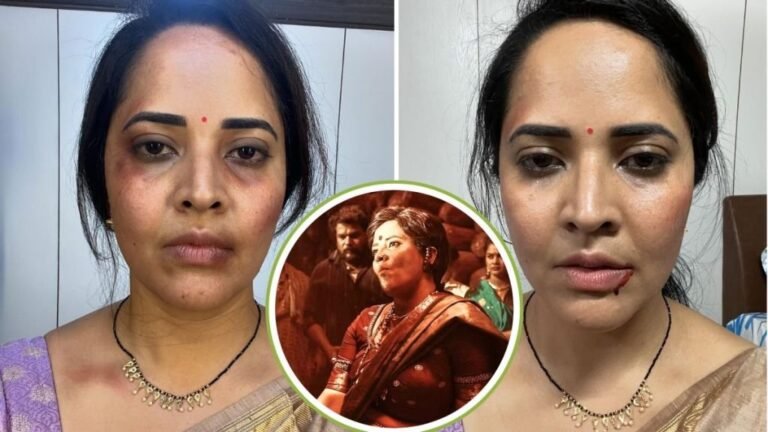 Pushpa-2-Dkshayani-aka-Anasuya-Bhardwaj-injuries